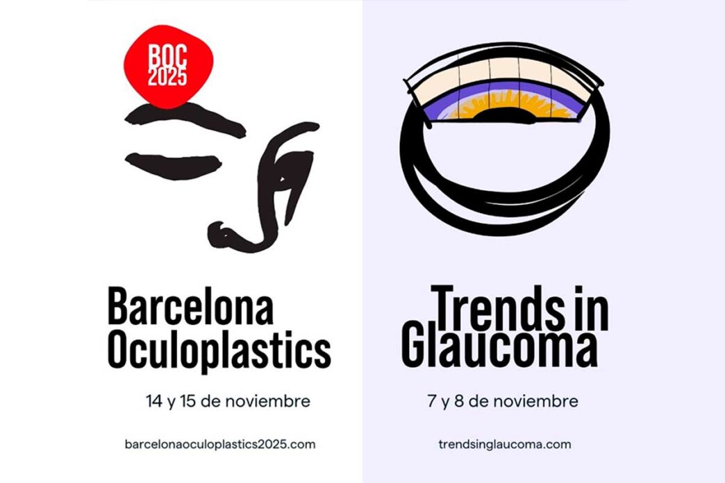 Trends in Glaucoma y BOC 2025